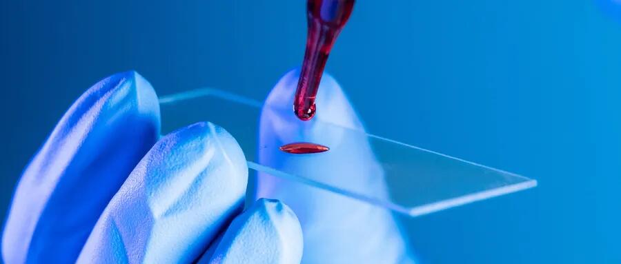 【原創(chuàng)研究】血液制品行業(yè)投研報告之二：國內(nèi)企業(yè)分離提純工藝仍有較大提升空間